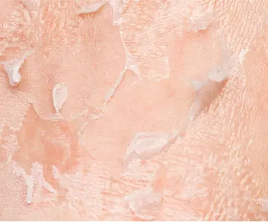 Non surgical facial treatment